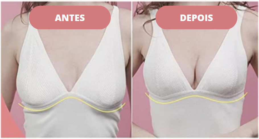 Sutiã Invisível